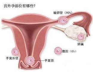 杰特宁医院供卵试管婴儿费用清单上有哪些项目？