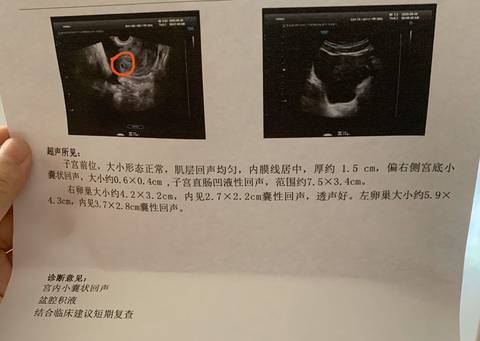 供卵试管婴儿技术如何全面解决遗传性疾病以保护儿童的健康？