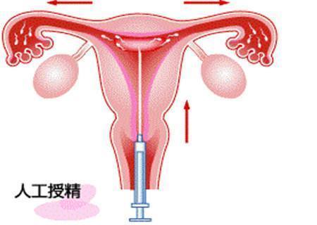 在供卵试管婴儿中检测怀孕的最新日子