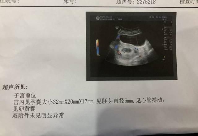 如何减少胚胎碎片以提高北京赠卵试管婴儿的怀孕率