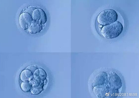 借卵做试管婴儿双胞胎真的那么容易吗？