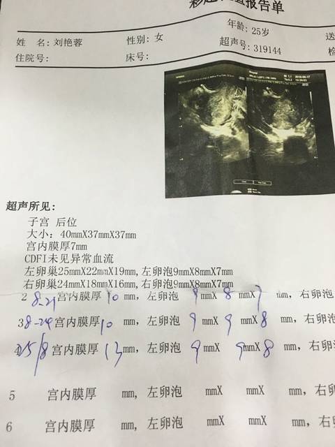 供卵试管婴儿后第三次B超检查是什么-孕期三维超声检查是什么？