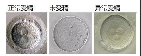 赠卵试管降调打哪里