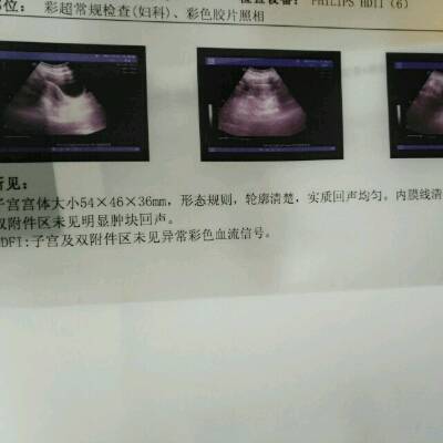 有没有赠卵试管一直不成功的