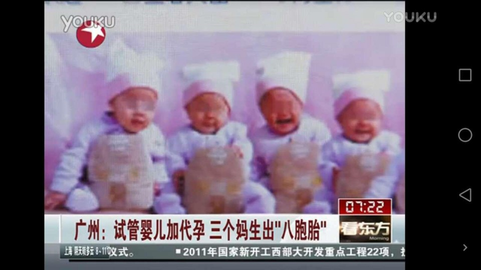 三代借卵做试管胎儿染色体异常概率