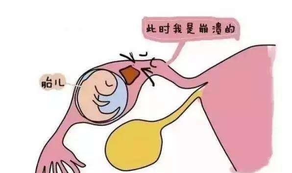 做供卵试管婴儿必须做无创DNA吗