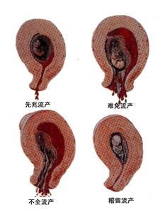 北京市第三代试管婴儿医院有几家