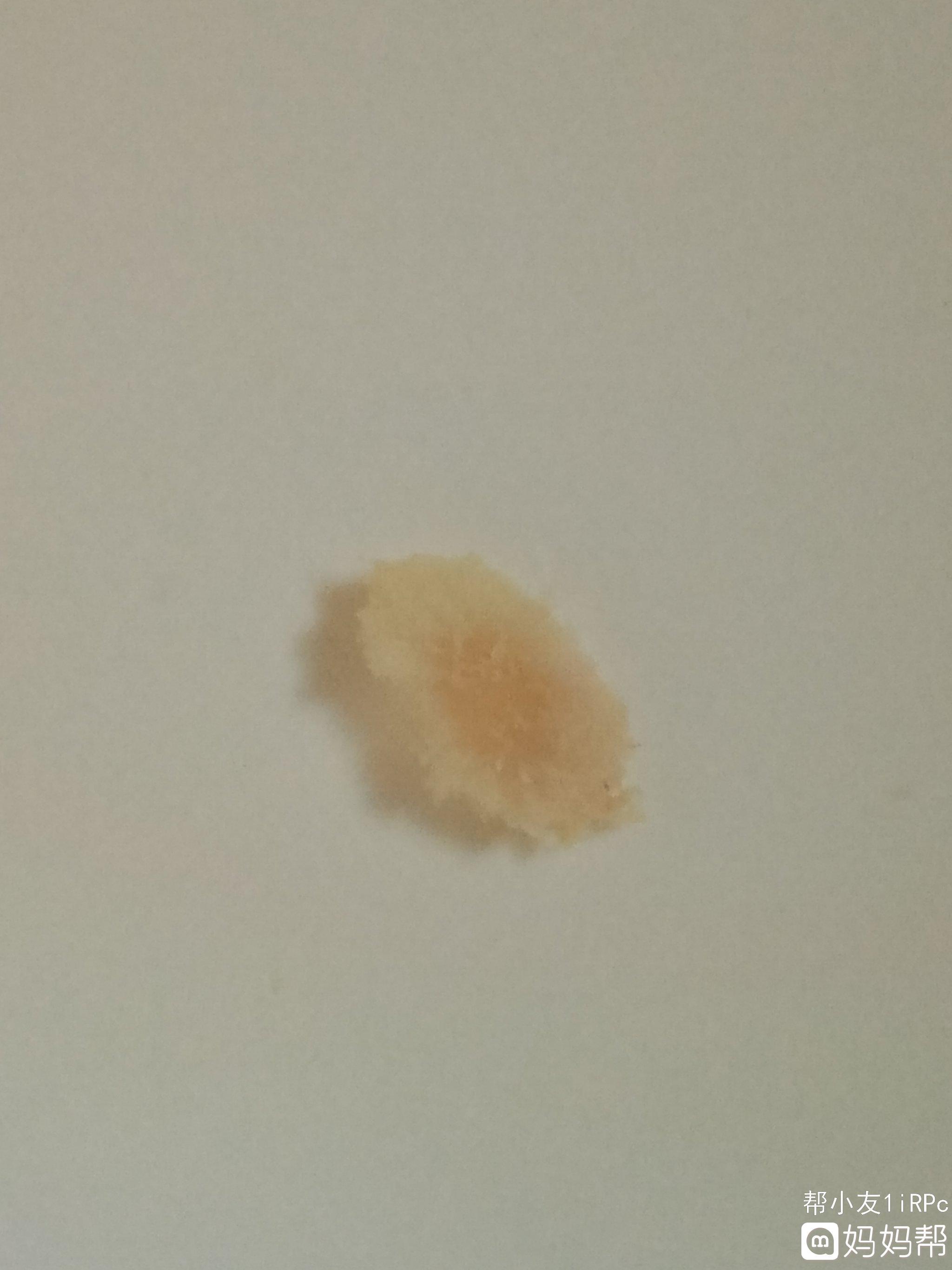 试管婴儿费用大概需要多少钱