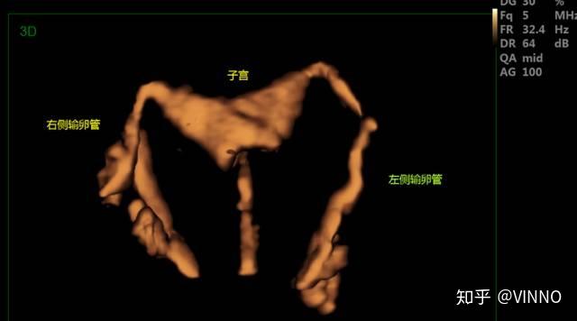 试管人工周期移植前用药的具体步骤是什么？