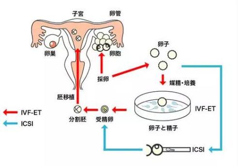 试管人工周期移植前用药的具体步骤是什么？