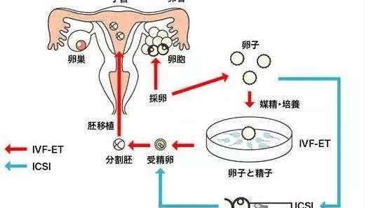 代怀生子流程移植失败后怎么办？4点处理方案要知悉