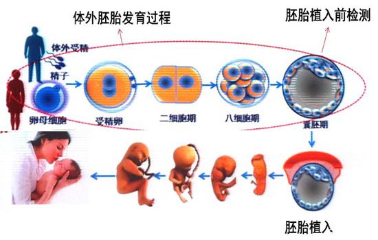 北京助孕中心对精子的要求高吗
