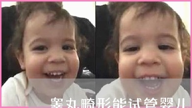 绝经女性可以用别人的卵子试管代怀2024婴儿吗（做赠卵试管成功率高吗？）