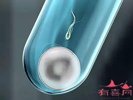 浙大妇院有人需要代生孩子吗费用