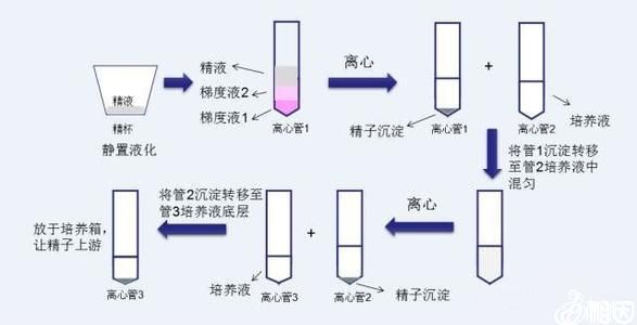 老公染色体平衡易位哪里试管代怀最便宜