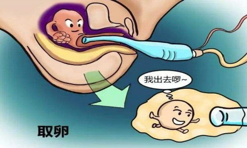 试管异卵双胞胎什么性别多+异卵双胞胎同性多还是异性多