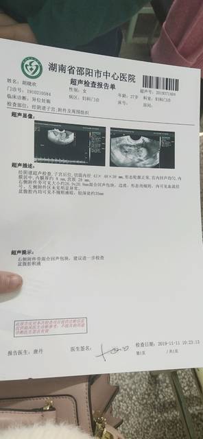 女性艾滋病试管成功案例分享,过来人告诉你真没想象中难