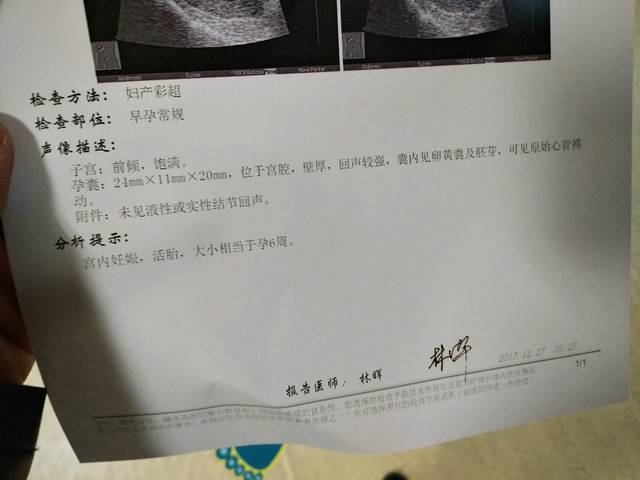 2024年新政策无业孕妇生第一胎国家补贴多少钱