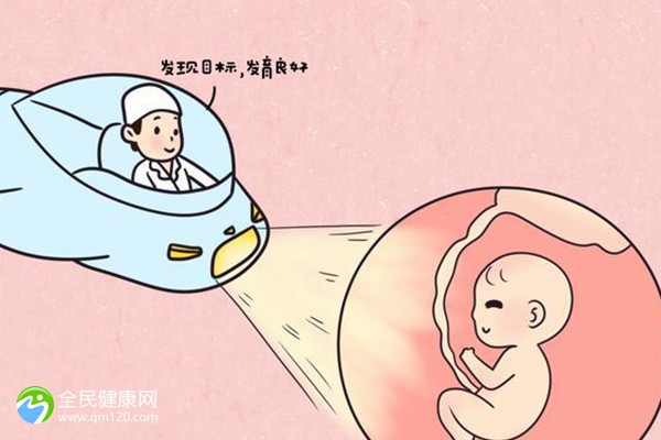 卵巢肿物的4种常见检查方法